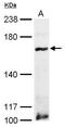 ATP Binding Cassette Subfamily B Member 1 antibody, PA5-28810, Invitrogen Antibodies, Western Blot image 