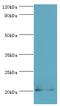 Prion Like Protein Doppel antibody, MBS1498935, MyBioSource, Western Blot image 