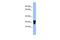 V-Set Immunoregulatory Receptor antibody, GTX46021, GeneTex, Western Blot image 