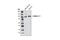 Catenin Delta 1 antibody, 4989S, Cell Signaling Technology, Western Blot image 