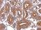 Cutaneous T-cell lymphoma-associated antigen 5 antibody, NBP2-16022, Novus Biologicals, Immunohistochemistry frozen image 