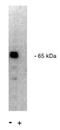 Protein Phosphatase 2 Regulatory Subunit B'Alpha antibody, orb108623, Biorbyt, Western Blot image 