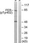 Flk antibody, TA313870, Origene, Western Blot image 