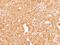 Coagulation Factor X antibody, NBP1-33320, Novus Biologicals, Immunohistochemistry paraffin image 