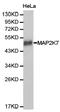 Mitogen-Activated Protein Kinase Kinase 7 antibody, LS-C192876, Lifespan Biosciences, Western Blot image 