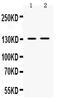 Transient Receptor Potential Cation Channel Subfamily M Member 5 antibody, PB9903, Boster Biological Technology, Western Blot image 