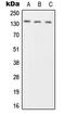 Protein Tyrosine Phosphatase Receptor Type N2 antibody, GTX55885, GeneTex, Western Blot image 