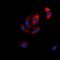 Mitogen-Activated Protein Kinase Kinase 6 antibody, orb318937, Biorbyt, Immunofluorescence image 