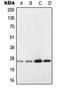 NADH dehydrogenase [ubiquinone] flavoprotein 2, mitochondrial antibody, orb214299, Biorbyt, Western Blot image 