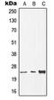Deoxythymidylate Kinase antibody, MBS821108, MyBioSource, Western Blot image 