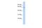 Polypeptide N-Acetylgalactosaminyltransferase 18 antibody, GTX46114, GeneTex, Western Blot image 