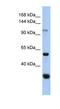 Glucosidase Alpha, Neutral C antibody, NBP1-56805, Novus Biologicals, Western Blot image 