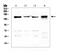 Lemur Tyrosine Kinase 3 antibody, A08432-2, Boster Biological Technology, Western Blot image 