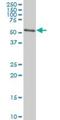 AKT Serine/Threonine Kinase 2 antibody, H00000208-M06, Novus Biologicals, Western Blot image 