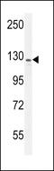 Inhibitor Of Bruton Tyrosine Kinase antibody, 55-375, ProSci, Western Blot image 