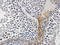 TNF Receptor Superfamily Member 25 antibody, orb74334, Biorbyt, Immunohistochemistry paraffin image 