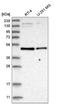 Solute Carrier Family 2 Member 2 antibody, NBP2-58182, Novus Biologicals, Western Blot image 