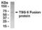 TNF Alpha Induced Protein 6 antibody, XW-8149, ProSci, Western Blot image 