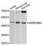 Serpin Family B Member 8 antibody, LS-C748100, Lifespan Biosciences, Western Blot image 