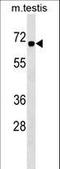 Chromobox 2 antibody, LS-C159274, Lifespan Biosciences, Western Blot image 