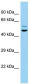 Dermal papilla-derived protein 13 antibody, TA343225, Origene, Western Blot image 