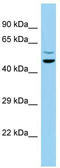 Succinyl-CoA:Glutarate-CoA Transferase antibody, TA343225, Origene, Western Blot image 