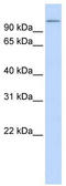 Thioredoxin Domain Containing 16 antibody, TA338438, Origene, Western Blot image 