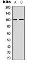 Nuclear Factor Kappa B Subunit 2 antibody, abx121447, Abbexa, Western Blot image 