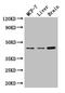 Potassium Voltage-Gated Channel Subfamily J Member 11 antibody, CSB-PA622781LA01HU, Cusabio, Western Blot image 