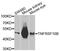 TNF Receptor Superfamily Member 10b antibody, STJ111955, St John