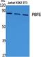 Enoyl-CoA Hydratase And 3-Hydroxyacyl CoA Dehydrogenase antibody, A05757-1, Boster Biological Technology, Western Blot image 