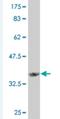 Angiopoietin-related protein 7 antibody, H00010218-M04-100ug, Novus Biologicals, Western Blot image 