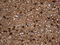 Doublecortin Like Kinase 1 antibody, LS-C798323, Lifespan Biosciences, Immunohistochemistry paraffin image 