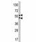 Carbonic Anhydrase 9 antibody, F48972-0.4ML, NSJ Bioreagents, Immunofluorescence image 