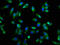 Colony Stimulating Factor 2 Receptor Beta Common Subunit antibody, LS-C669988, Lifespan Biosciences, Immunofluorescence image 