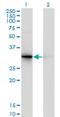 Proenkephalin-B antibody, H00005173-M01, Novus Biologicals, Western Blot image 