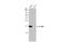 Interferon Induced Transmembrane Protein 1 antibody, GTX101728, GeneTex, Western Blot image 