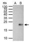 MYC Associated Factor X antibody, GTX113492, GeneTex, Immunoprecipitation image 