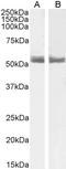 Retinoic Acid Receptor Alpha antibody, LS-C55366, Lifespan Biosciences, Western Blot image 