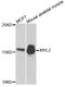 Myosin Light Chain 2 antibody, LS-C346089, Lifespan Biosciences, Western Blot image 
