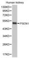Presenilin 1 antibody, AHP2512, Bio-Rad (formerly AbD Serotec) , Western Blot image 