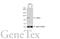 Lysyl Oxidase Like 2 antibody, GTX105085, GeneTex, Western Blot image 