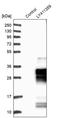 Ankyrin Repeat And SOCS Box Containing 9 antibody, PA5-51795, Invitrogen Antibodies, Western Blot image 