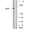 DEAQ-Box RNA Dependent ATPase 1 antibody, A16175, Boster Biological Technology, Western Blot image 