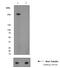 Acetyl-CoA Carboxylase Alpha antibody, ab68191, Abcam, Western Blot image 