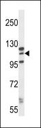 MORC Family CW-Type Zinc Finger 1 antibody, 57-096, ProSci, Western Blot image 
