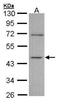 Inositol-Tetrakisphosphate 1-Kinase antibody, NBP1-32678, Novus Biologicals, Western Blot image 