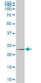 NOP16 Nucleolar Protein antibody, LS-C133758, Lifespan Biosciences, Western Blot image 