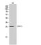 Tumor necrosis factor ligand superfamily member 8 antibody, STJ97317, St John