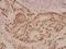 Protein Tyrosine Phosphatase Non-Receptor Type 1 antibody, A00613Y46, Boster Biological Technology, Immunohistochemistry paraffin image 